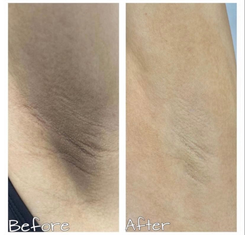 Exfoliante “aclarante e hidratante”. Hadassa