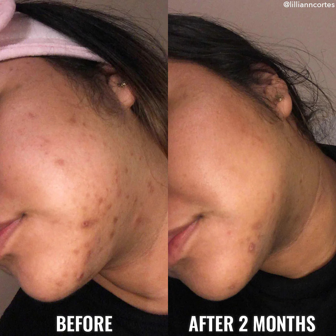 Discoloration Correcting Serum Good Molecules